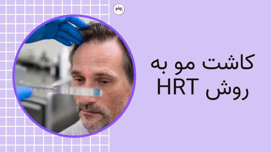 کاشت مو به روش HRT